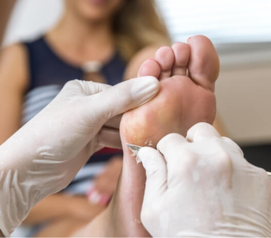 Woman Receiving Chiropody Treatment