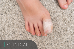 ingrowing toenail bandage
