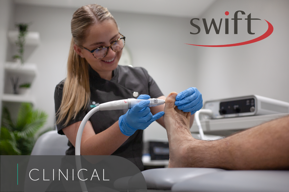 swift verruca treatment